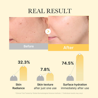 Medicube Kojic Acid Turmeric Gold Jelly Gel Mask