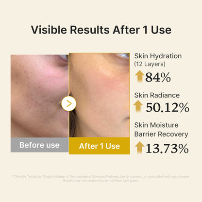 Medicube Kojic Acid Turmeric Vitamin Gold Jelly Mist Serum