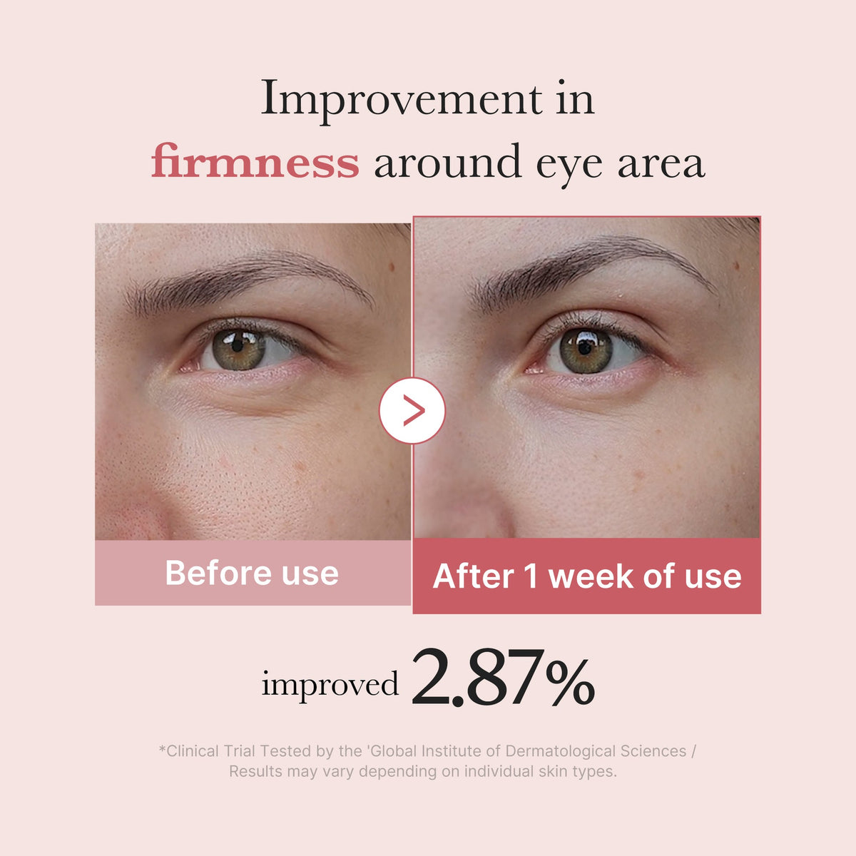 Medicube PDRN Pink Peptide Eye Cream