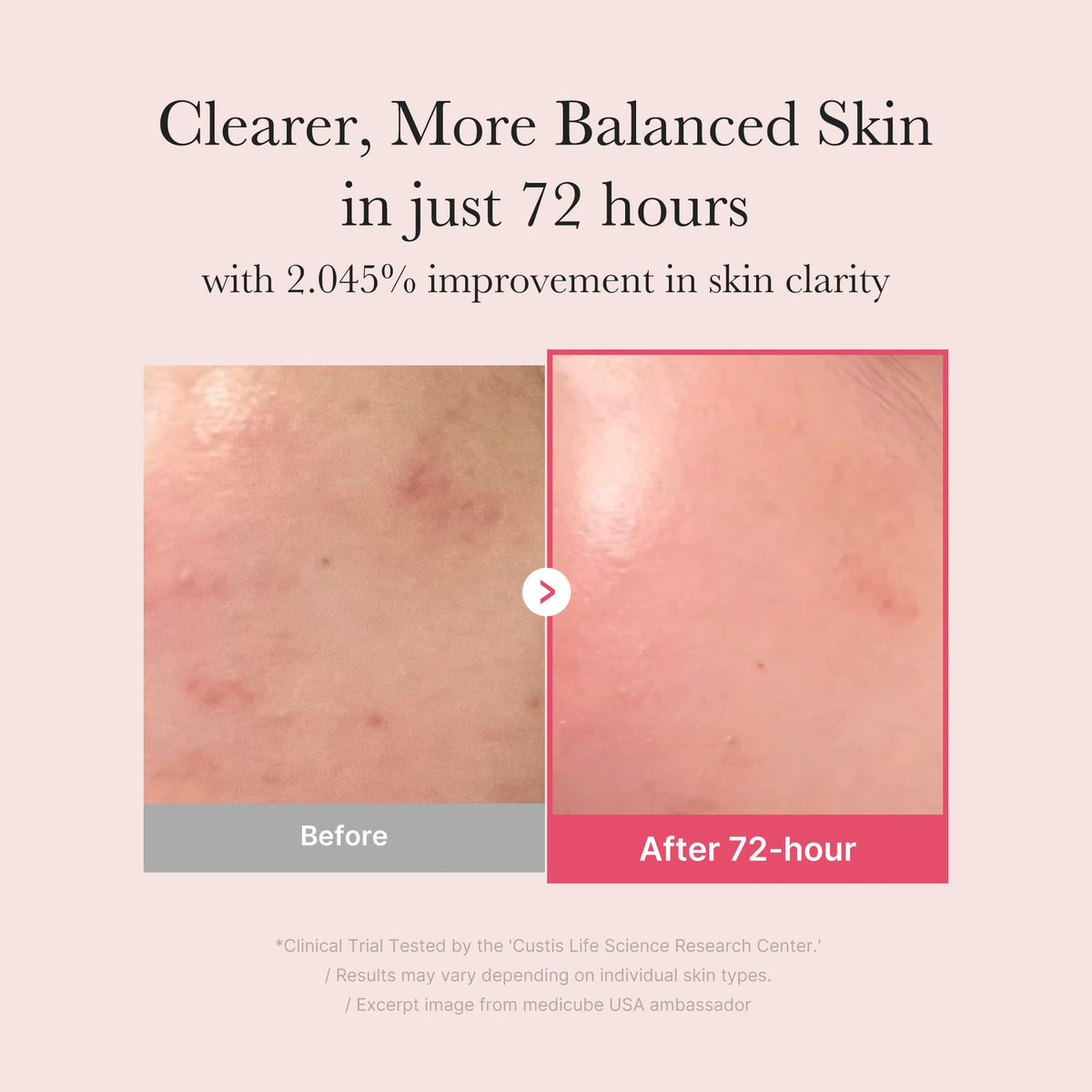 Medicube TXA Niacinamide Serum
